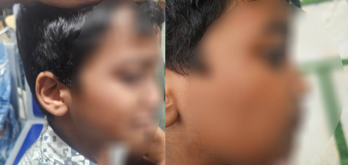 വയനാട്ടില്‍ ചികിത്സയ്ക്കിടെ ഡോക്ടര്‍ ഏഴ് വയസുകാരന്റെ മുഖത്തടിച്ചതായി പരാതി