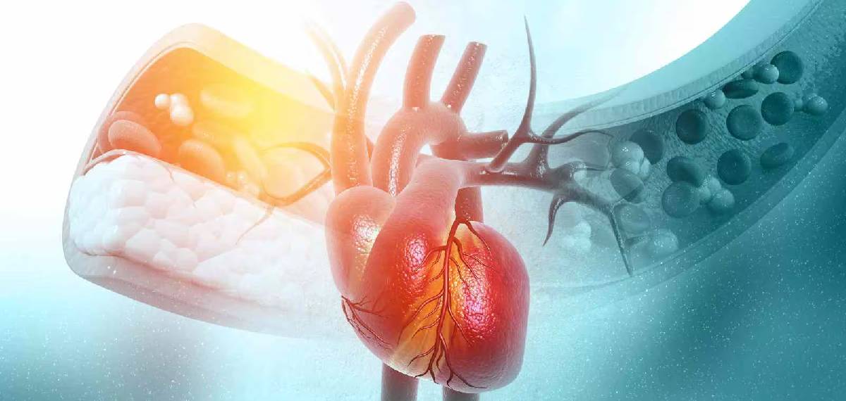 cholesterol thin people