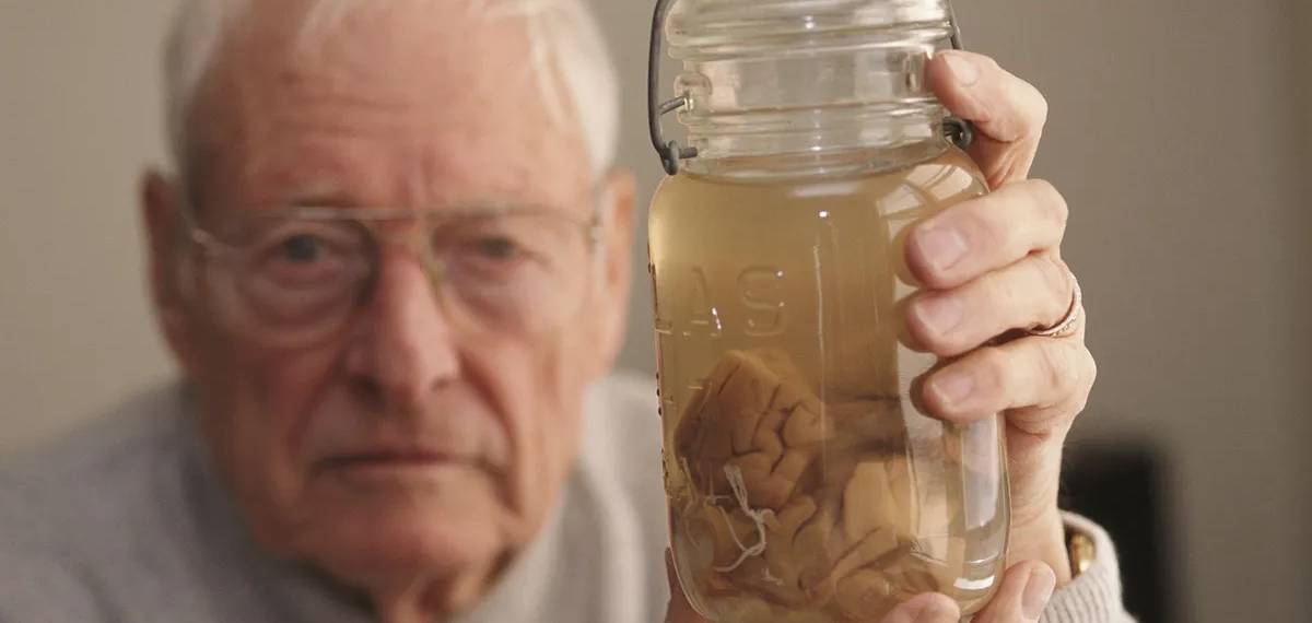 albert einstein brain