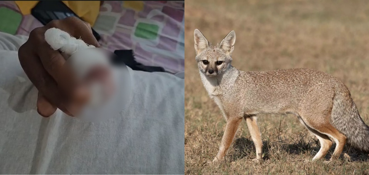 വടകരയില് കുറുനരി യുവാവിന്റെ കൈവിരല് കടിച്ചെടുത്തു