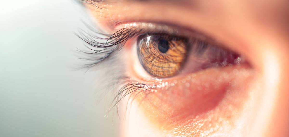 കാഴ്ചമങ്ങല്; ഡോക്ടറെ കാണാനെത്തിയ യുവതിക്ക് ഗുരുതരമായ വൃക്കരോഗം സ്ഥിരീകരിച്ചു