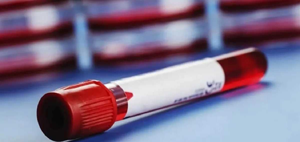 Why is human blood red