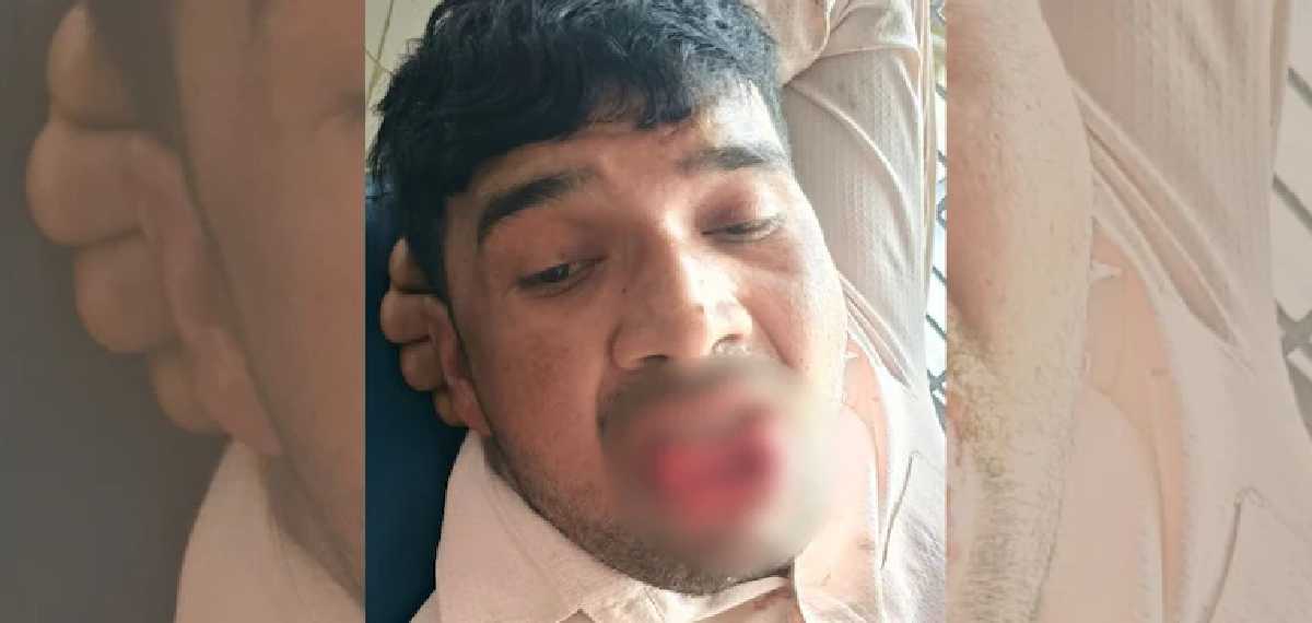 ബന്ധത്തിൽ നിന്ന് പിന്മാറിയിട്ടും വിടാതെ മുൻ കാമുകൻ; ബലമായി ചുംബിക്കാൻ ശ്രമിച്ചു; നാവ് കടിച്ച് മുറിച്ച് യുവതി