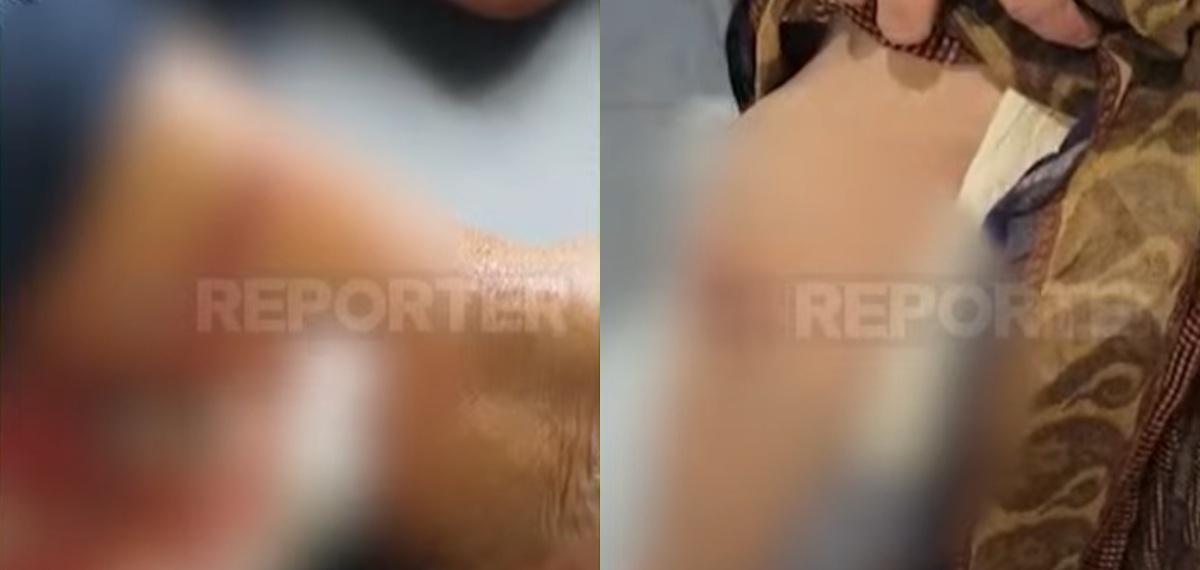 പാലക്കാട് ഒറ്റപ്പാലത്ത് തെരുവുനായ ആക്രമണം; ഏഴ് വയസുകാരൻ ഉൾപ്പെടെ ആറ് പേർക്ക് കടിയേറ്റു
