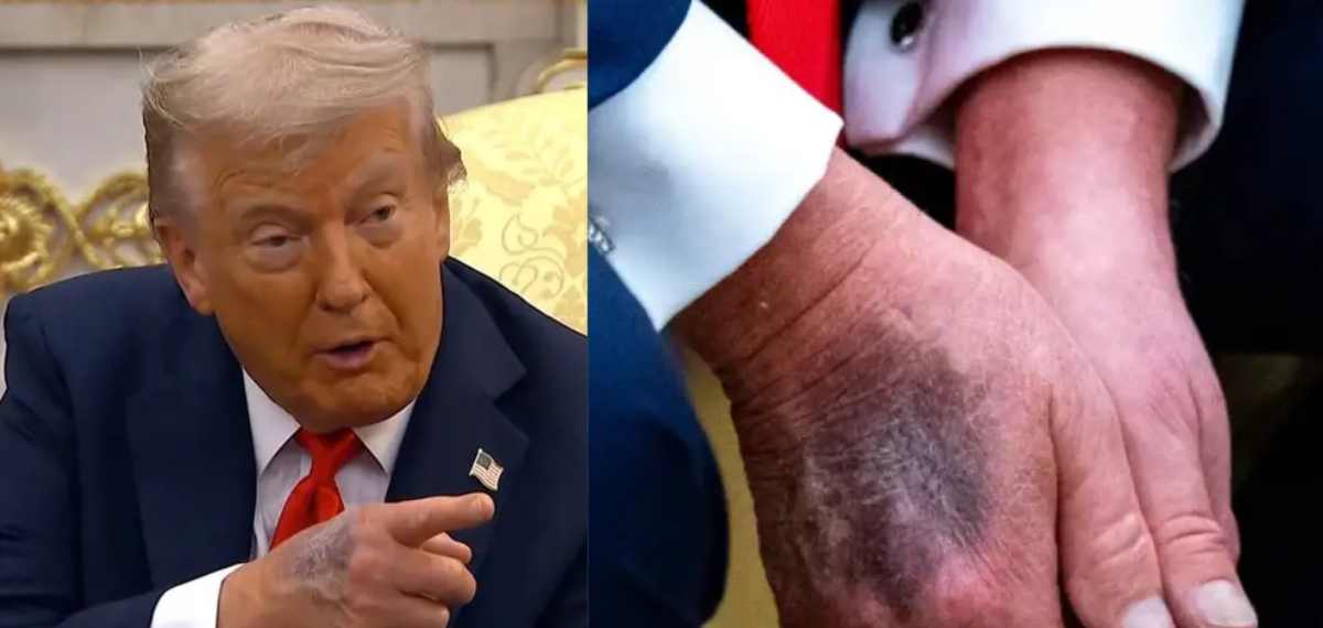 'Trump is dead!': ട്രംപിന്റെ ആരോഗ്യത്തിൽ ആശങ്ക പടർത്തി ട്രെൻഡിങ് ഹാഷ്ടാഗ്, സിംപ്‌സൺസിൻറെ പ്രവചനം സത്യമാകുമോ
