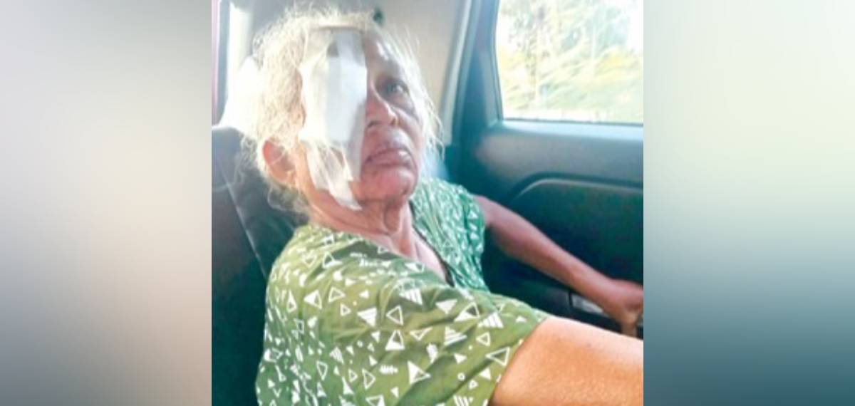 അയല്‍ വീട്ടിലേക്ക് പോയ വയോധികയുടെ ക​ണ്ണി​ൽ പ​രു​ന്ത് കൊ​ത്തി; പ​രി​ക്ക്