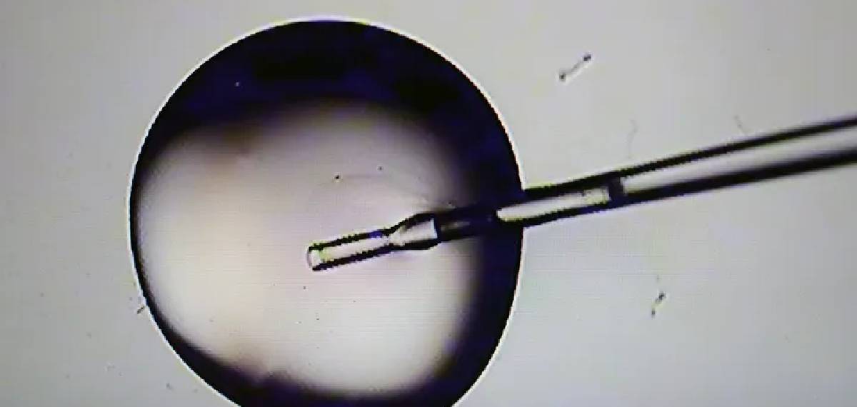  breakthrough technique that converts DNA from skin cells into human eggs capable of producing embryos