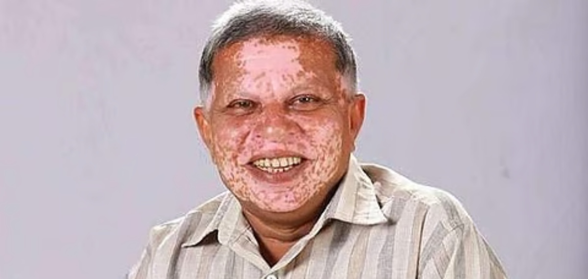 'സിദ്ദിഖിന് കാണ്ടാമൃഗത്തിൻ്റെ തൊലിക്കട്ടി,ദുരന്തബാധിത‍ർക്ക് എന്ന് വീട് കൊടുക്കുമെന്ന് കോൺഗ്രസ് പറയണം'