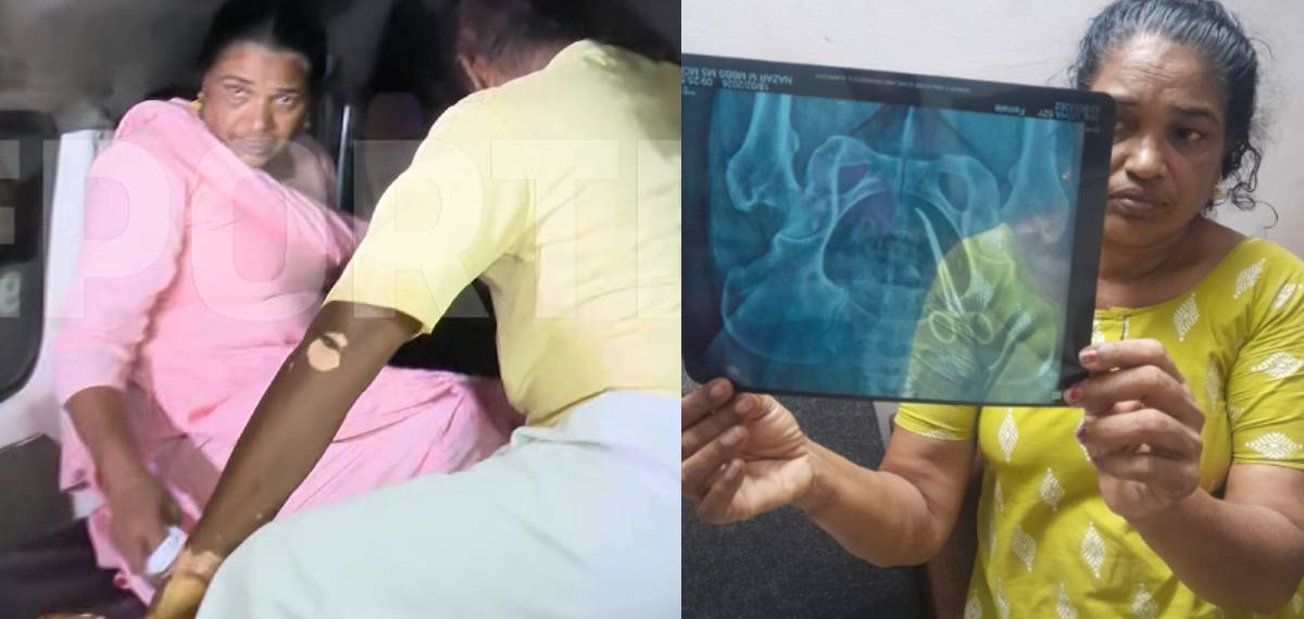 ആലപ്പുഴയിൽ വീട്ടമ്മയുടെ വയറ്റില്‍ കത്രിക കുടുങ്ങിയ സംഭവം: ഉഷ ജോസഫിനെ ആശുപത്രിയിലേക്ക് മാറ്റി