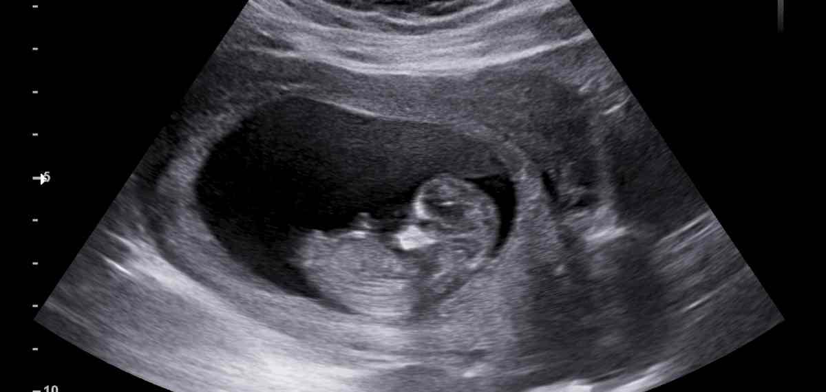 New study reveals a Genetic Switch that allows pregnancy