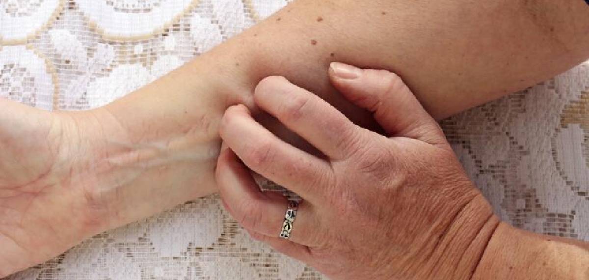 liver failure symptoms