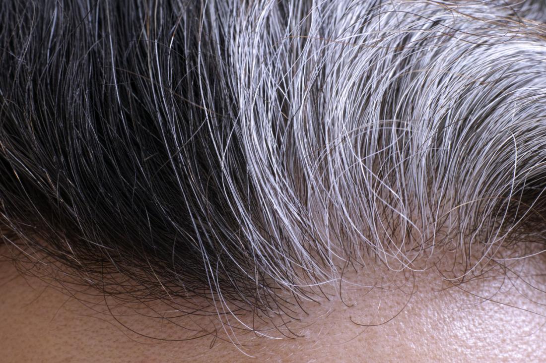 gray hair